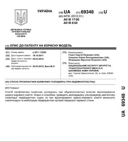 Патент на корисну модель 69348 - Симулик Є. В. Патент на полезную модель 69348 - Симулик Е. В.