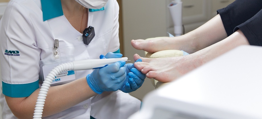 Коррекция деформированных ногтей