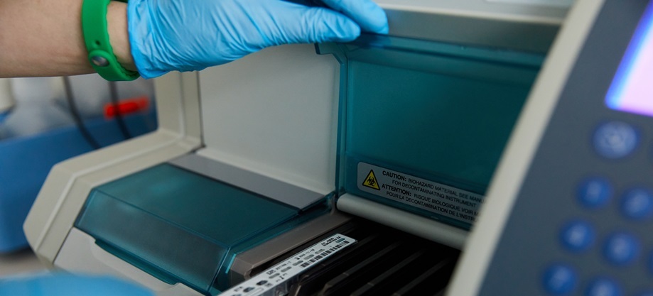 Анализ на кортизол в Киеве