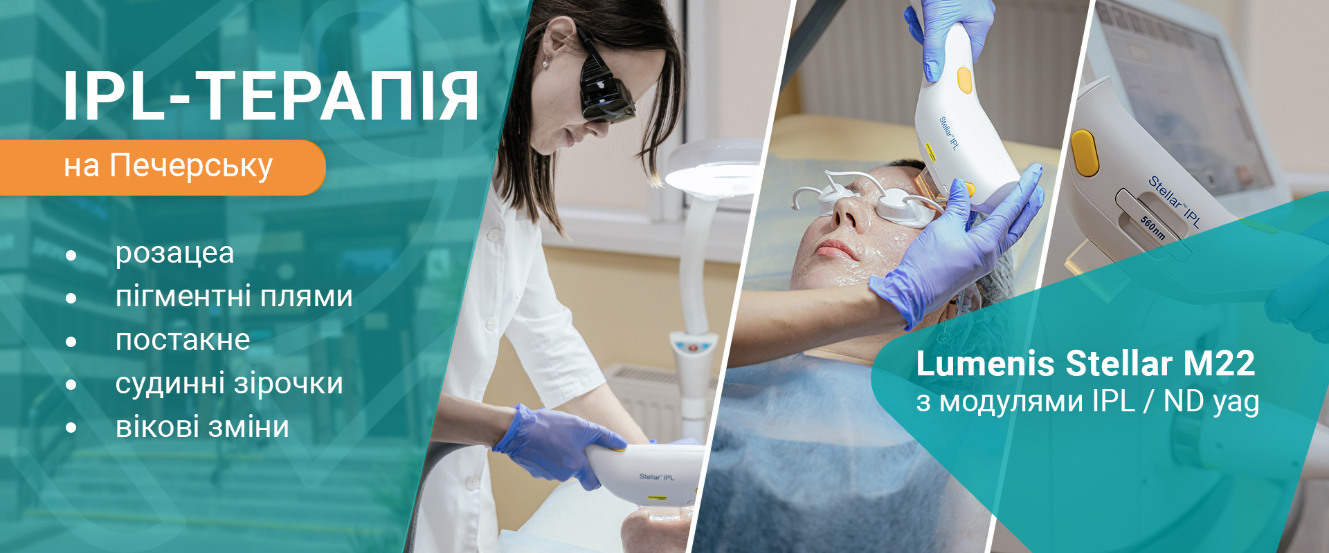 IPL-терапия Киев IPL-терапія Київ