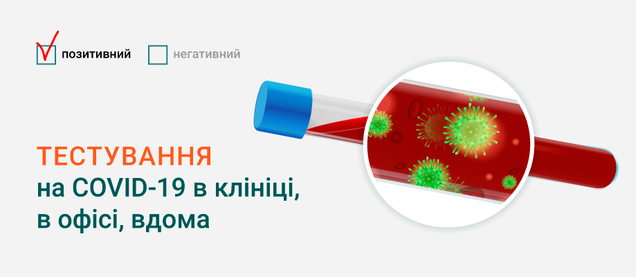 тест на коронавирус тест на коронавирус