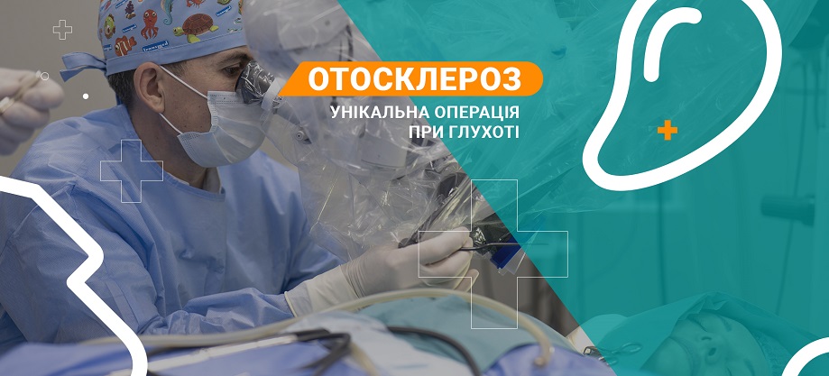 Стапедопластика лечение отосклероза Стапедопластика лікування отосклерозу
