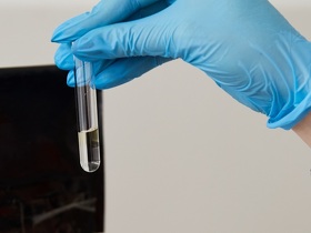 Анализ мочи