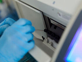 Анализ на кортизол