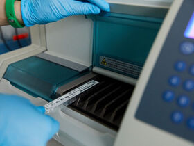 Анализ на ревматоидный фактор