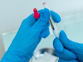 Анализ на С-реактивный белок