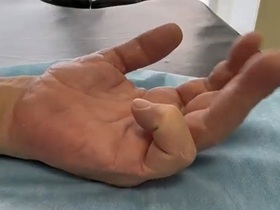 Кейс: болезнь Нотта