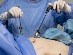 Кейс: Лапароскопическое удаление кисты печени