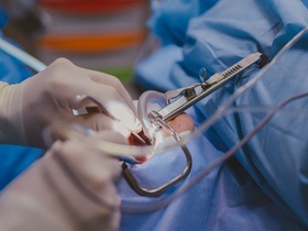 Кейс:комплексное лечение хронического тонзиллита и искривленной носовой перегородки