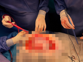 Кейс: велика пухлина черевної порожнини Кейс: большая опухоль брюшной полости