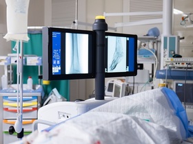 Кейс: стентирование бедренной артерии