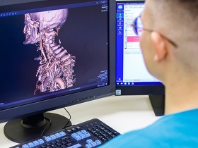 Лимфома Лімфома