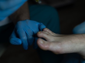 Що таке мікоз? Что такое микоз?