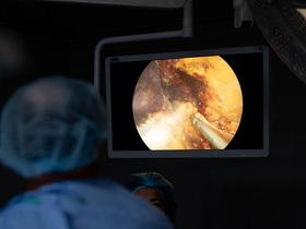 Цистэктомия