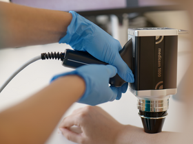 Дерматоскопия