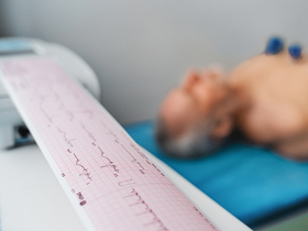 Кардиограмма