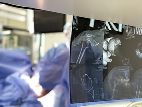 Эндопротезирование плечевого сустава	