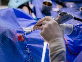 Эндоскопическая риносинусохирургия (FESS)