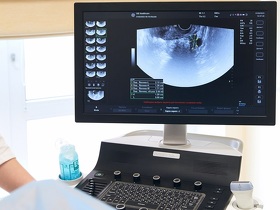 Гиперплазия эндометрия