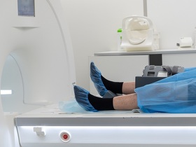 Хондромаляция надколенника Хондромаляція надколінка