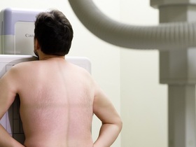 Туберкульоз