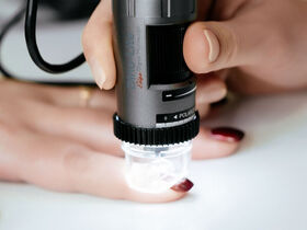 Капилляроскопия в Киеве