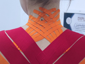 Кинезиологическое тейпирование