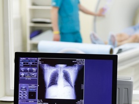 КТ грудной клетки