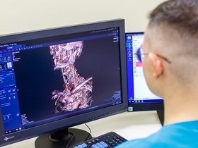 КТ шийного відділу хребта КТ шейного отдела позвоночника