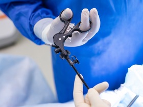 Лапароскопічна холецистектомія Лапароскопия холецистэктомия