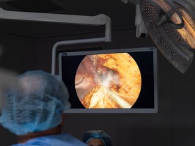 Лапароскопічна нефректомія