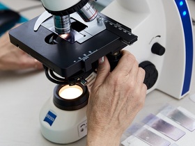 Лечение папилломавируса (ВПЧ)