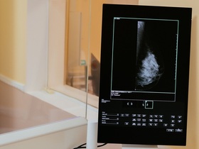 Маммография или УЗИ: что лучше выбрать