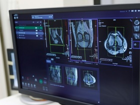 Остеоартроз