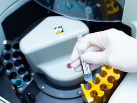 передопераційне обстеження