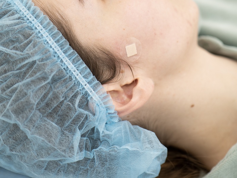 P1049307.jpg родимка загоюється