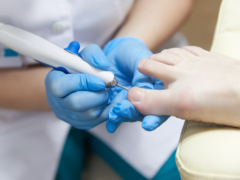 344A1828.jpg деформація нігтів