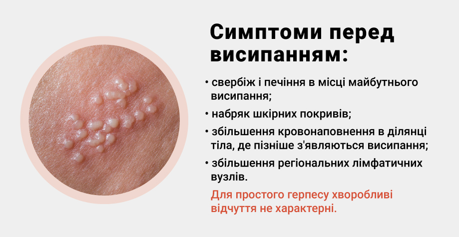 Герпетическая инфекция (herpes simplex)