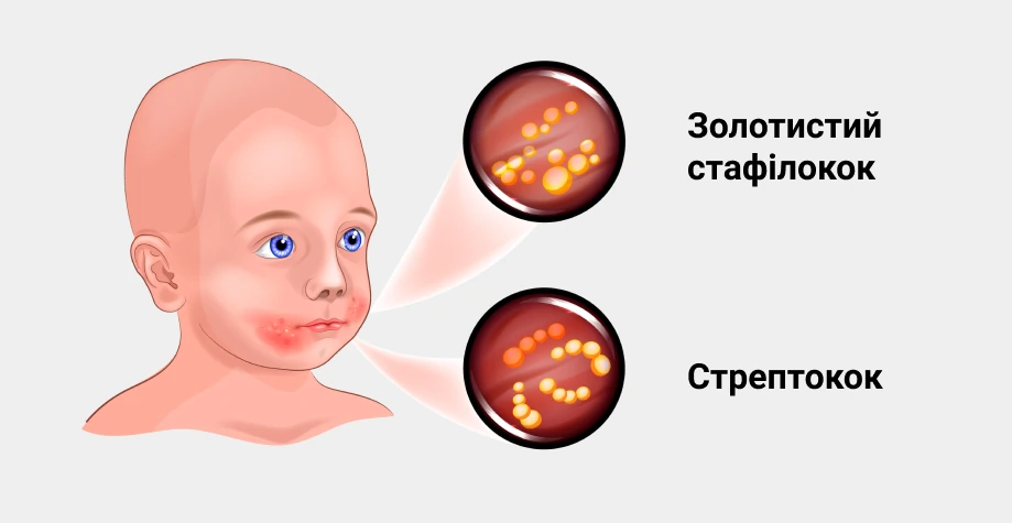 Піоз