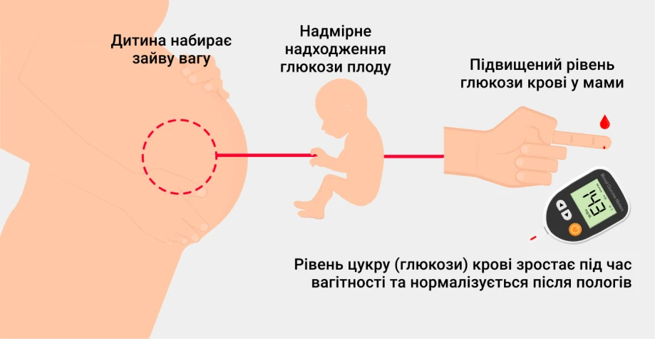 Симптомы диабета при беременности