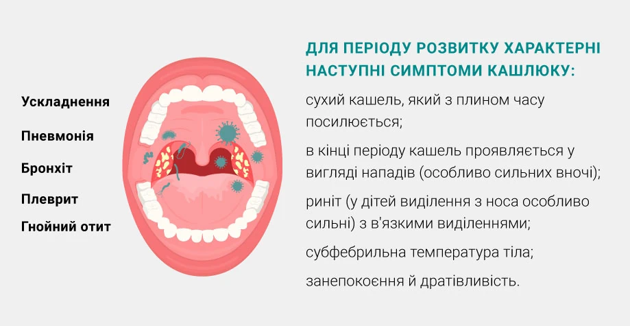 Коклюш