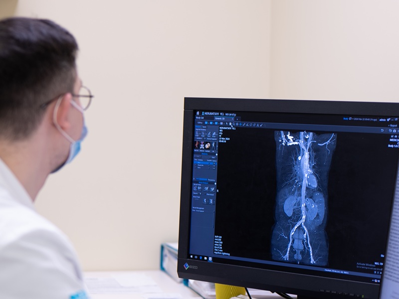 P1137028.jpg исследование сосудов