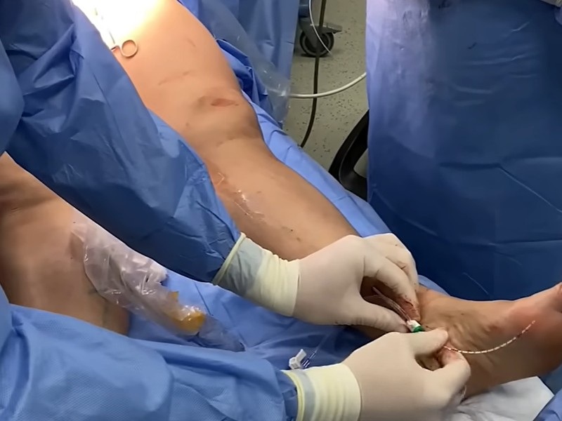 сосудистая хирургия сосудистая хирургия