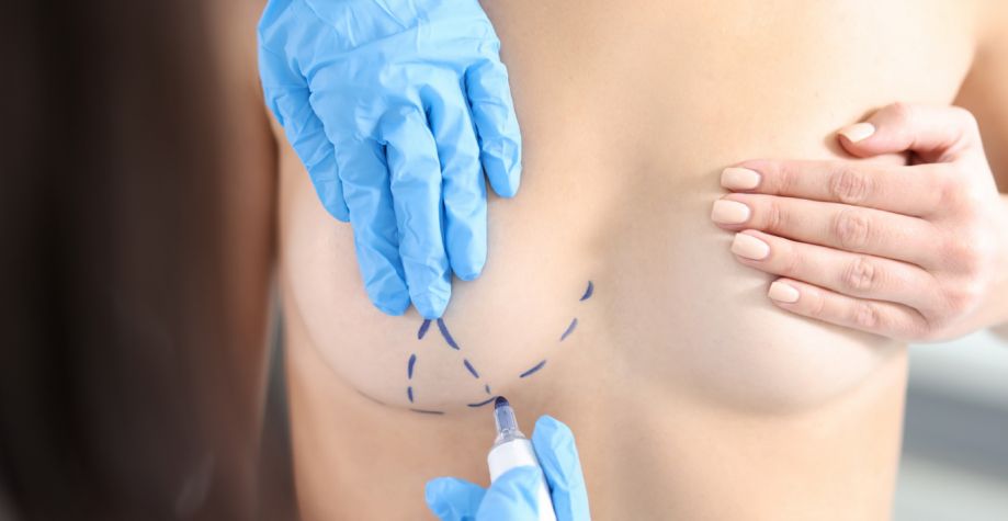 Показания для липофилинга груди
