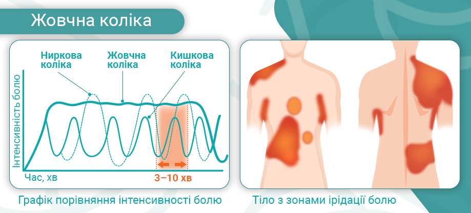 колика печень колика печень