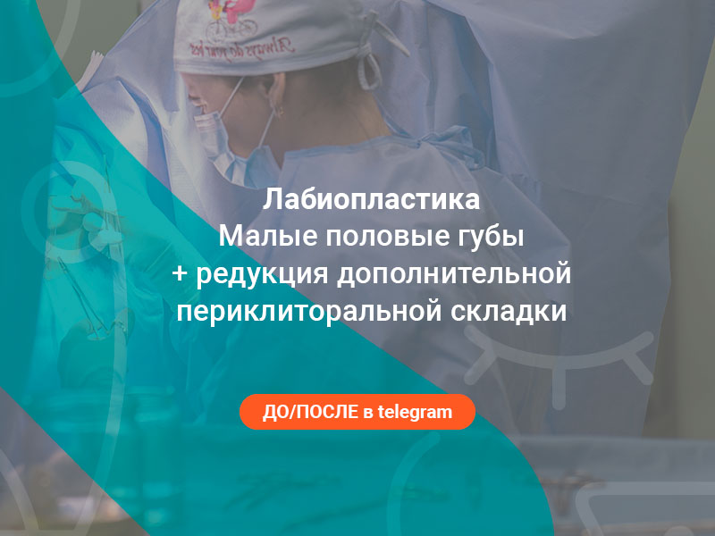 пластика