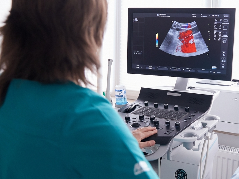 gin_folikulyarnaya kista.png USD