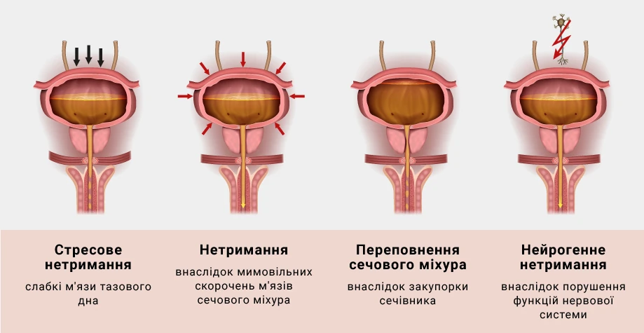 Дизурія