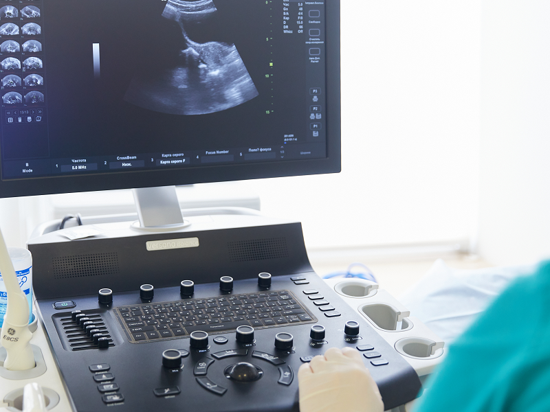 uzi_amenoreya.png УЗД сечового міхура