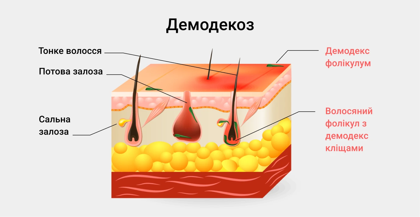Демодекоз